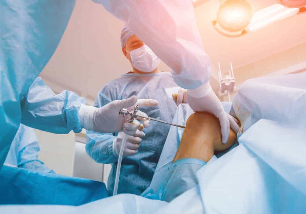 Arthroscopy Treatment